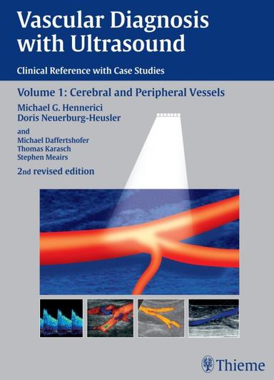 Vascular Diagnosis with Ultrasound